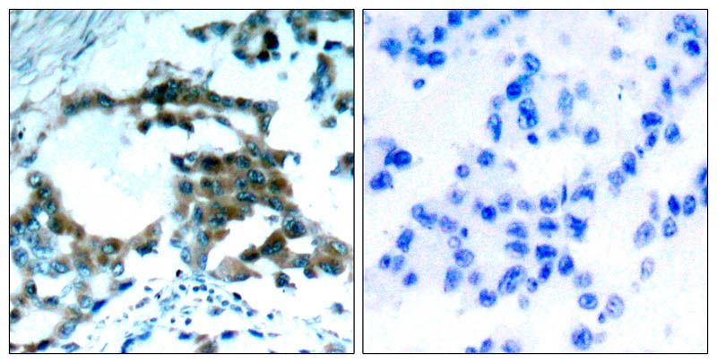 PKCθ (Phospho-Ser695) Rabbit Polyclonal Antibody, 100 ug