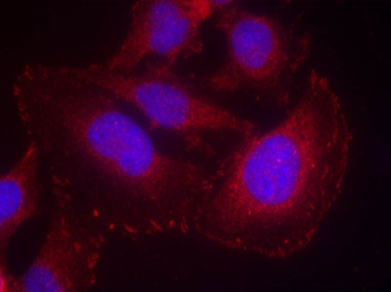 PLC-γ1 (phospho-Tyr771) Rabbit Polyclonal Antibody, 100 ug
