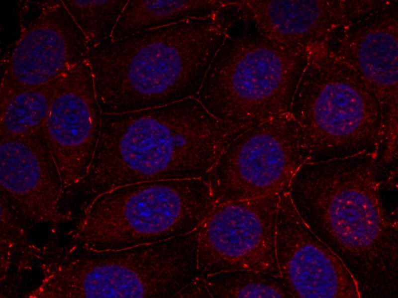IGF-1R(Phospho-Tyr1161) Rabbit Polyclonal Antibody, 100 ug