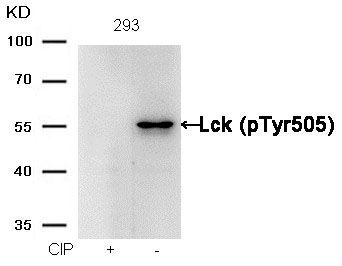 Lck (phospho-Tyr505) Rabbit Polyclonal Antibody, 100 ug