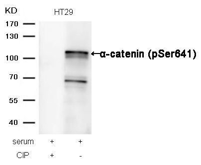 α-catenin (Phospho-Ser641) Rabbit Polyclonal Antibody, 100 ug