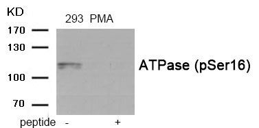 ATPase (Phospho-Ser16) Rabbit Polyclonal Antibody, 100 ug