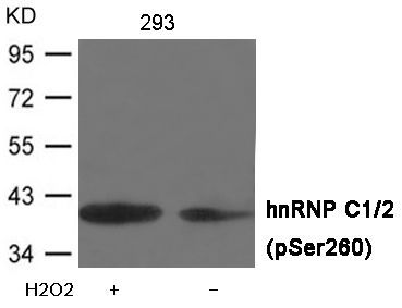 hnRNP C1/2 (Phospho-Ser260) Rabbit Polyclonal Antibody, 100 ug