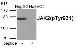 JAK2 (Phospho-Tyr931) Rabbit Polyclonal Antibody, 100 ug