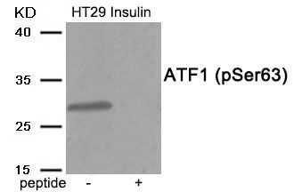 ATF1 (Phospho-Ser63) Rabbit Polyclonal Antibody, 100 ug