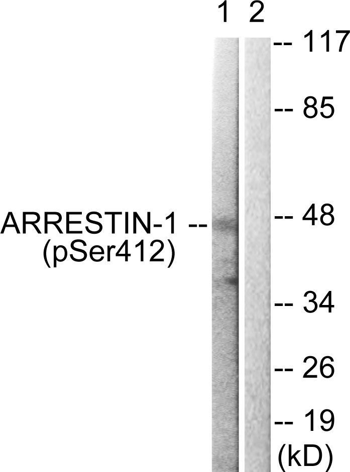Arrestin 1 (Phospho-Ser412) Rabbit Polyclonal Antibody, 100 ug
