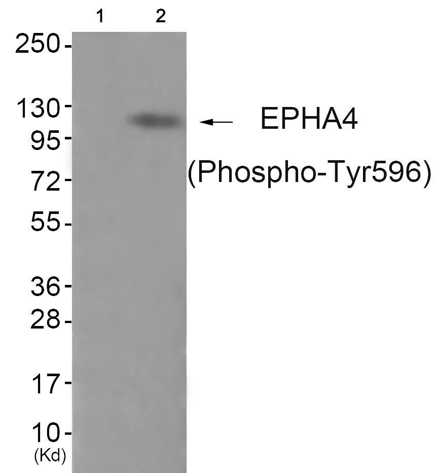 EPHA4 (Phospho-Tyr596) Rabbit Polyclonal Antibody, 100 ug