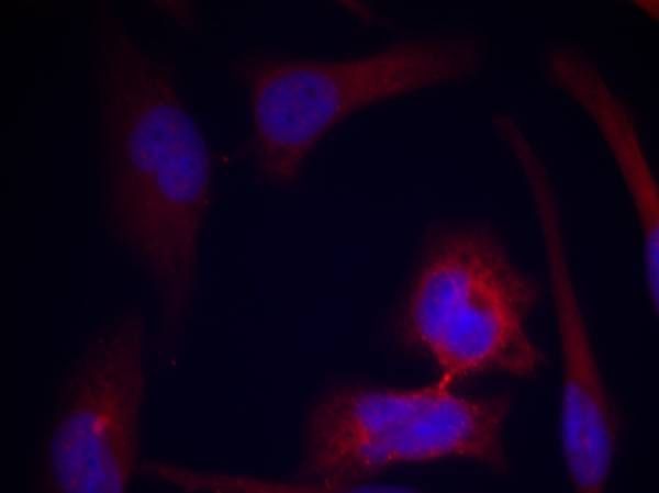 S6 Ribosomal Protein (Phospho-Ser235) Rabbit Polyclonal Antibody, 100 ug