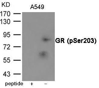 GR (Phospho-Ser203) Rabbit Polyclonal Antibody, 100 ug