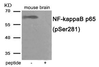 NF- kappaB p65 (Phospho-Ser281) Rabbit Polyclonal Antibody, 100 ug