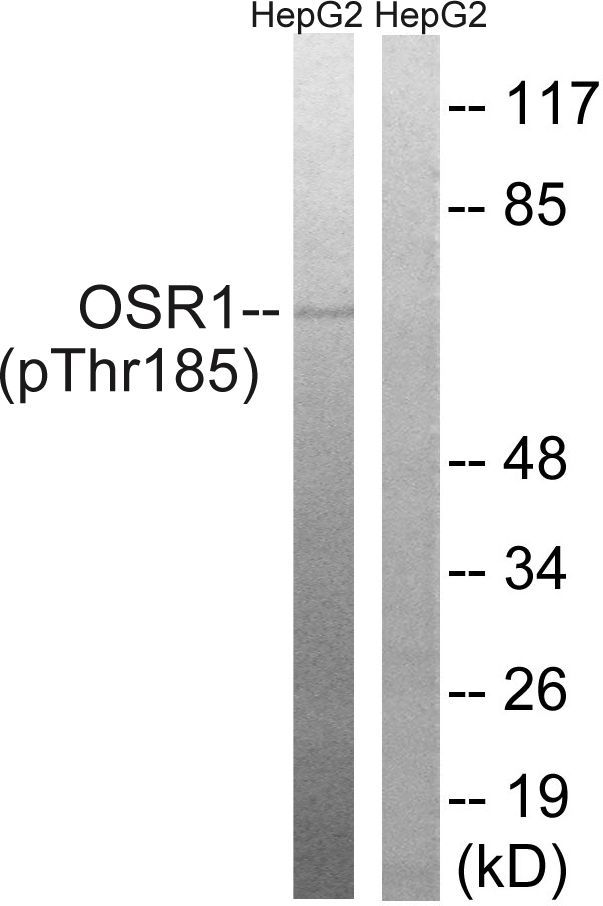 OSR1 (Phospho-Thr185) Rabbit Polyclonal Antibody, 100 ug