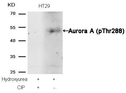 Aurora A (phospho-Thr288) Rabbit Polyclonal Antibody, 100 ug