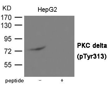 PKC delta (Phospho-Tyr313) Rabbit Polyclonal Antibody, 100 ug