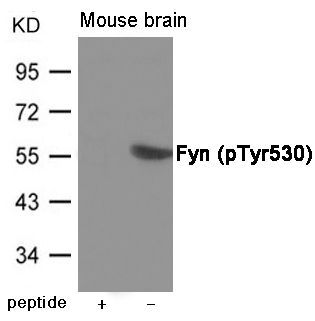 Fyn (Phospho-Tyr530) Rabbit Polyclonal Antibody, 100 ug