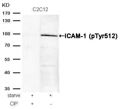 ICAM-1 (Phospho-Tyr512) Rabbit Polyclonal Antibody, 100 ug