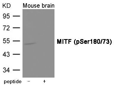 MITF (Phospho-Ser180/73) Rabbit Polyclonal Antibody, 100 ug
