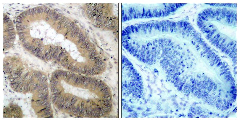 IKK α (Phospho-Thr23) Rabbit Polyclonal Antibody, 100 ug