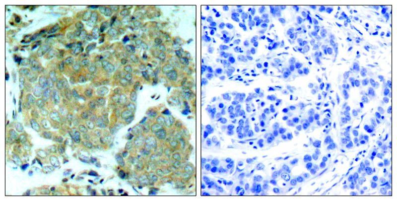 eIF2α (Phospho-Ser51) Rabbit Polyclonal Antibody, 100 ug