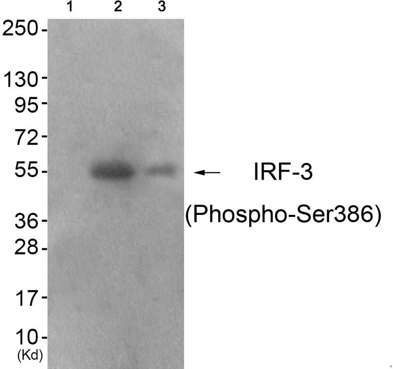 IRF-3 (Phospho-Ser386) Rabbit Polyclonal Antibody, 100 ug