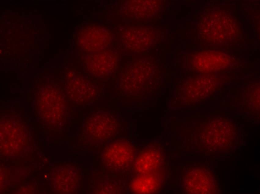p70 S6 Kinase (Phospho-Thr421) Rabbit Polyclonal Antibody, 100 ug