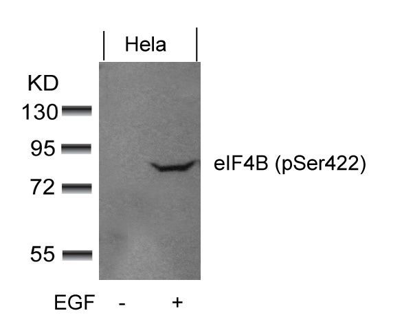 eIF4B (phospho-Ser422) Rabbit Polyclonal Antibody, 100 ug