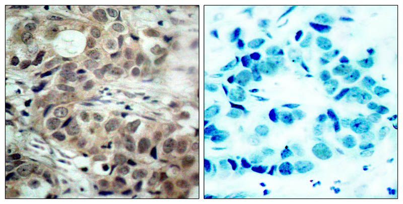 cdc25C (Phospho-Ser216) Rabbit Polyclonal Antibody, 100 ug