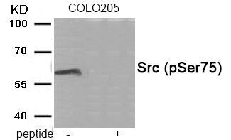 Src (Phospho-Ser75) Rabbit Polyclonal Antibody, 100 ug