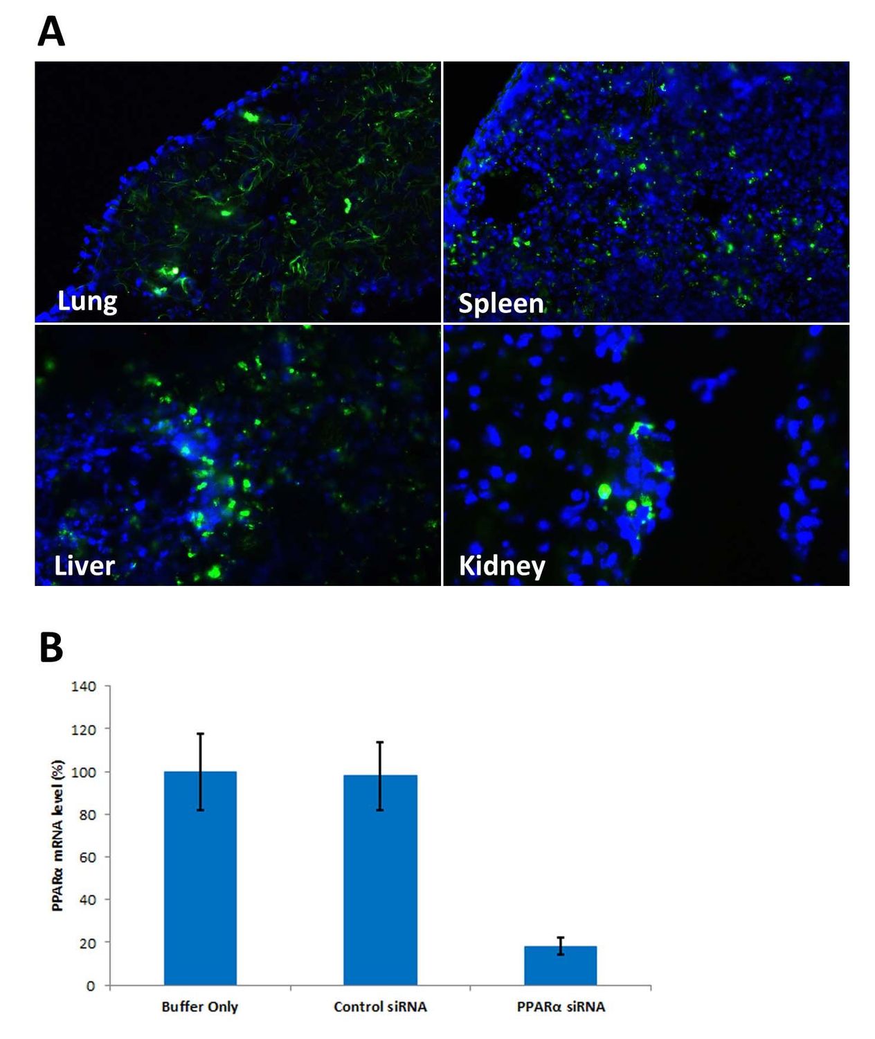 Calu-3 Cell Avalanche™ Transfection Reagent (human lung carcinoma cell) ,1.5ml