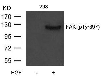 VASP (Phospho-Ser157) Rabbit Polyclonal Antibody, 100 ug