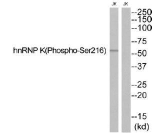 hnRNP K (Phospho-Ser216) Rabbit Polyclonal Antibody, 100 ug