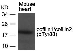 cofilin1/cofilin2 (phospho-Tyr88) Rabbit Polyclonal Antibody, 100 ug