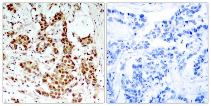 p90RSK (Phospho-Thr348) Rabbit Polyclonal Antibody, 100 ug