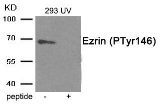 Ezrin (Phospho-Tyr146) Rabbit Polyclonal Antibody, 100 ug