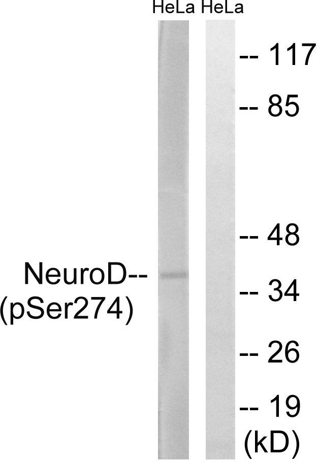 Neuro D (Phospho-Ser274) Rabbit Polyclonal Antibody, 100 ug