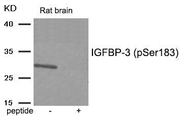 IGFBP-3 (Phospho-Ser183) Rabbit Polyclonal Antibody, 100 ug
