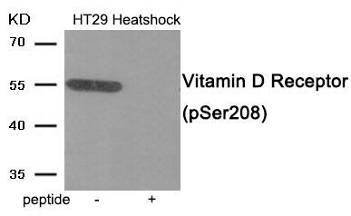 Vitamin D Receptor (Phospho-Ser208) Rabbit Polyclonal Antibody, 100 ug