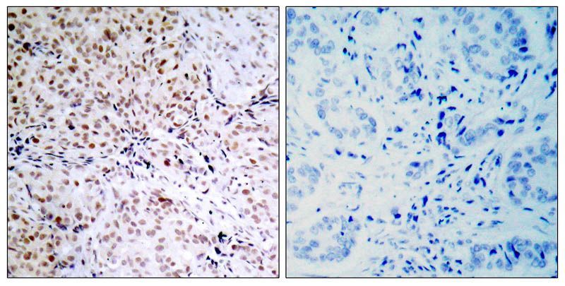 Rb (Phospho-Ser795) Rabbit Polyclonal Antibody, 100 ug