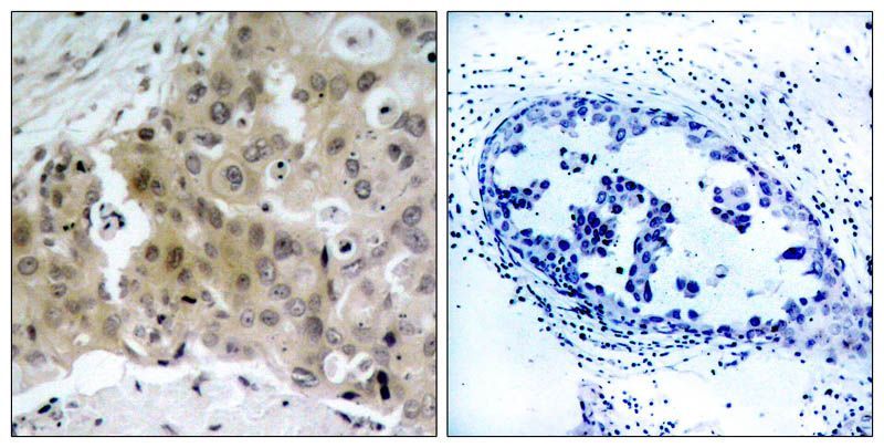 VEGFR2 (Phospho-Tyr1175) Rabbit Polyclonal Antibody, 100 ug