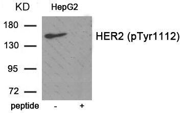 HER2 (Phospho-Tyr1112) Rabbit Polyclonal Antibody, 100 ug