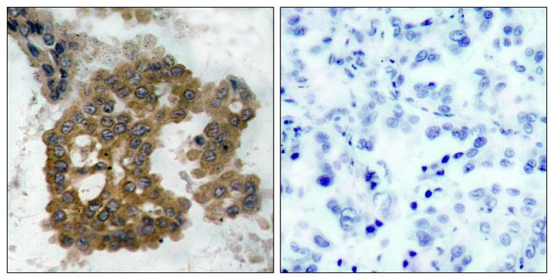 Akt2 (Phospho-Ser474) Rabbit Polyclonal Antibody, 100 ug