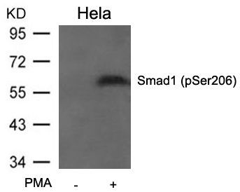 Smad1 (Phospho-Ser206) Rabbit Polyclonal Antibody, 100 ug