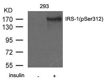 IRS-1(Phospho-Ser312) Rabbit Polyclonal Antibody, 100 ug