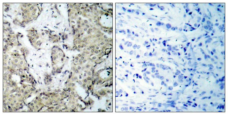 MKK3 (Phospho-Ser189) Rabbit Polyclonal Antibody, 100 ug