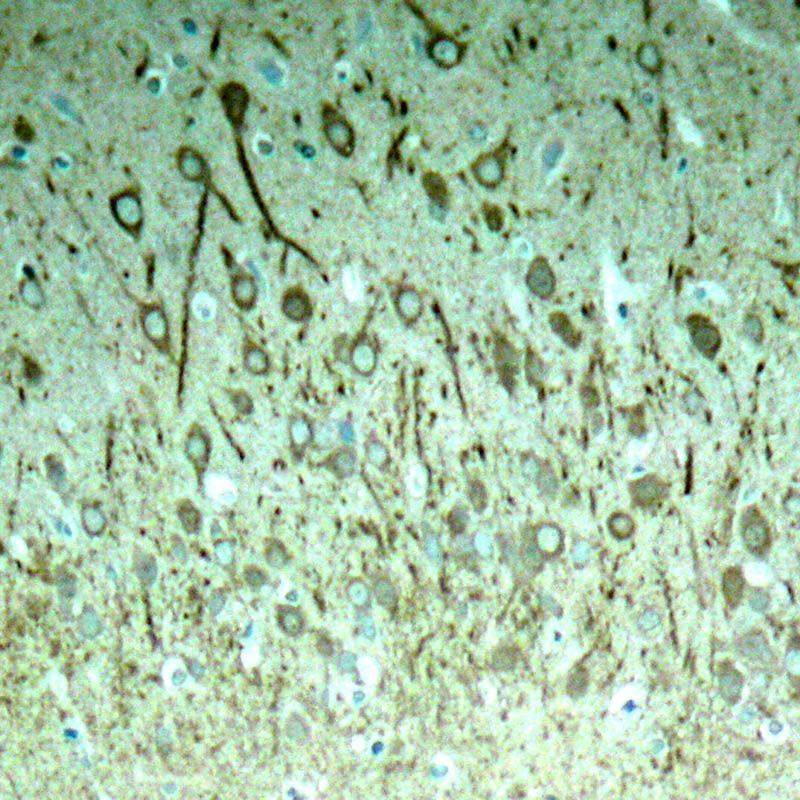 Tau (Phospho-Thr231) Rabbit Polyclonal Antibody, 100 ug