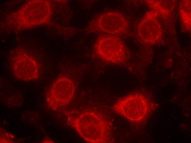 eIF4E (Phospho-Ser209) Rabbit Polyclonal Antibody, 100 ug