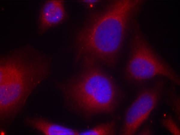 MARCKS (Phospho-Ser158) Rabbit Polyclonal Antibody, 100 ug