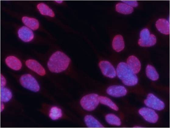 Histone H3 (Tri-Methyl-Lys27) Rabbit Polyclonal Antibody, 100 ug