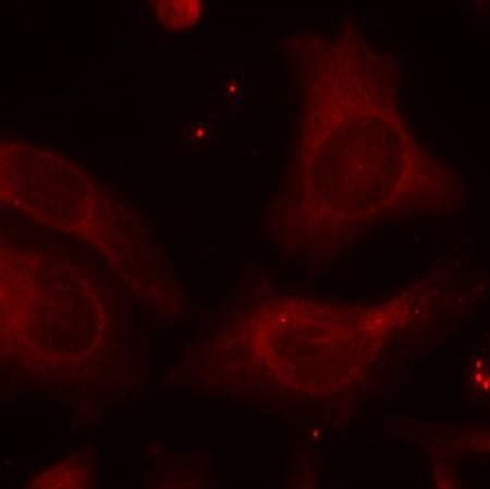 NFκB-p105(Phospho-Ser927) Rabbit Polyclonal Antibody, 100 ug
