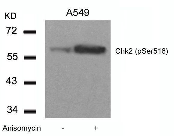 Chk2 (Phospho-Ser516) Rabbit Polyclonal Antibody, 100 ug