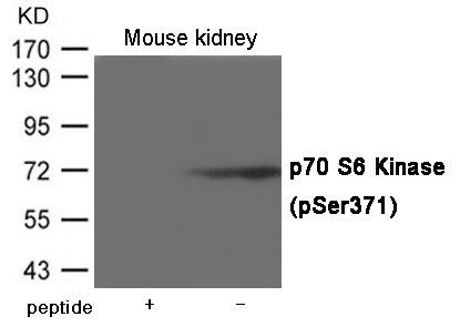 p70 S6 Kinase (Ser371) Rabbit Polyclonal Antibody, 100 ug